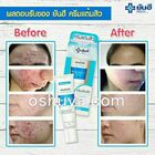 ヤンヒー病院特製アクネクリーム YANHEE Acne Cream 7g
